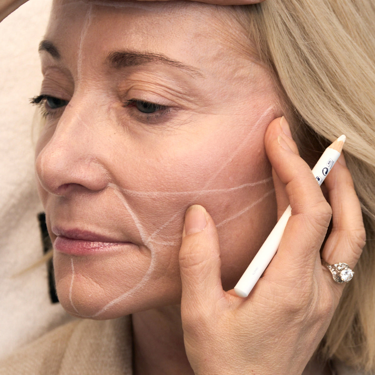 Fillerbehandling – LNDA Skin Clinic